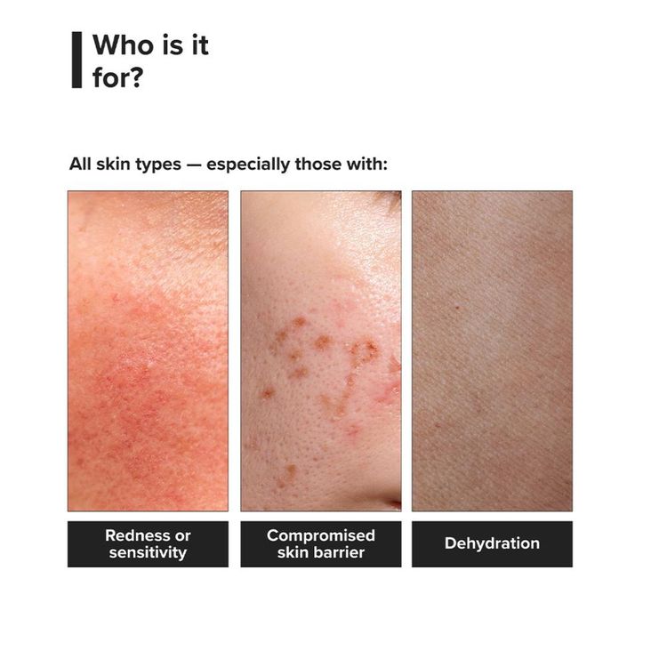 Minimalist B12 + Repair Complex 5.5% Face Moisturizer
(50g)