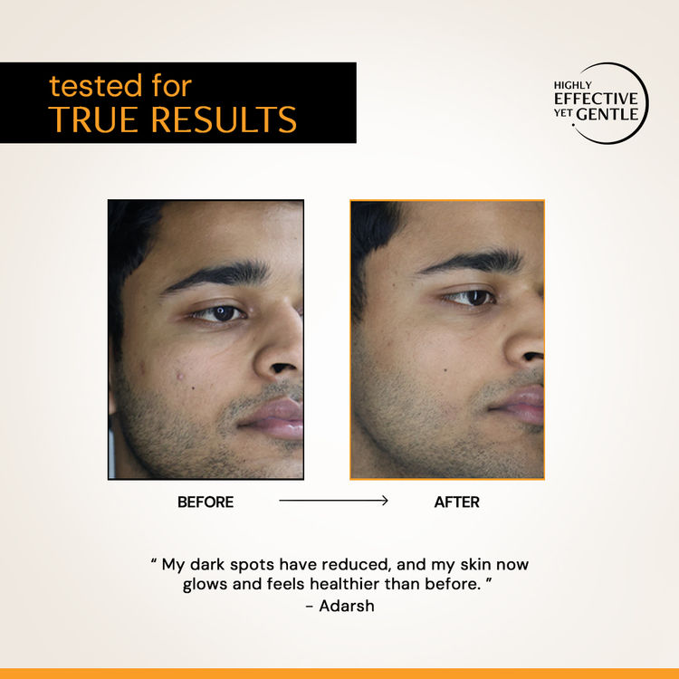 Deconstruct 10% Vitamin C Serum, Brightens, Evens Tone, Non-Irritating
(20ml)
