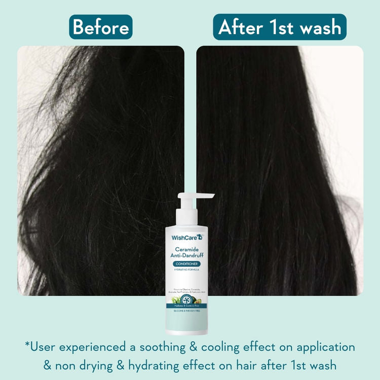 Wishcare Hydrating AHA BHA Anti Dandruff Shampoo & Conditioner Combo - Reduces Flakes & Itchiness