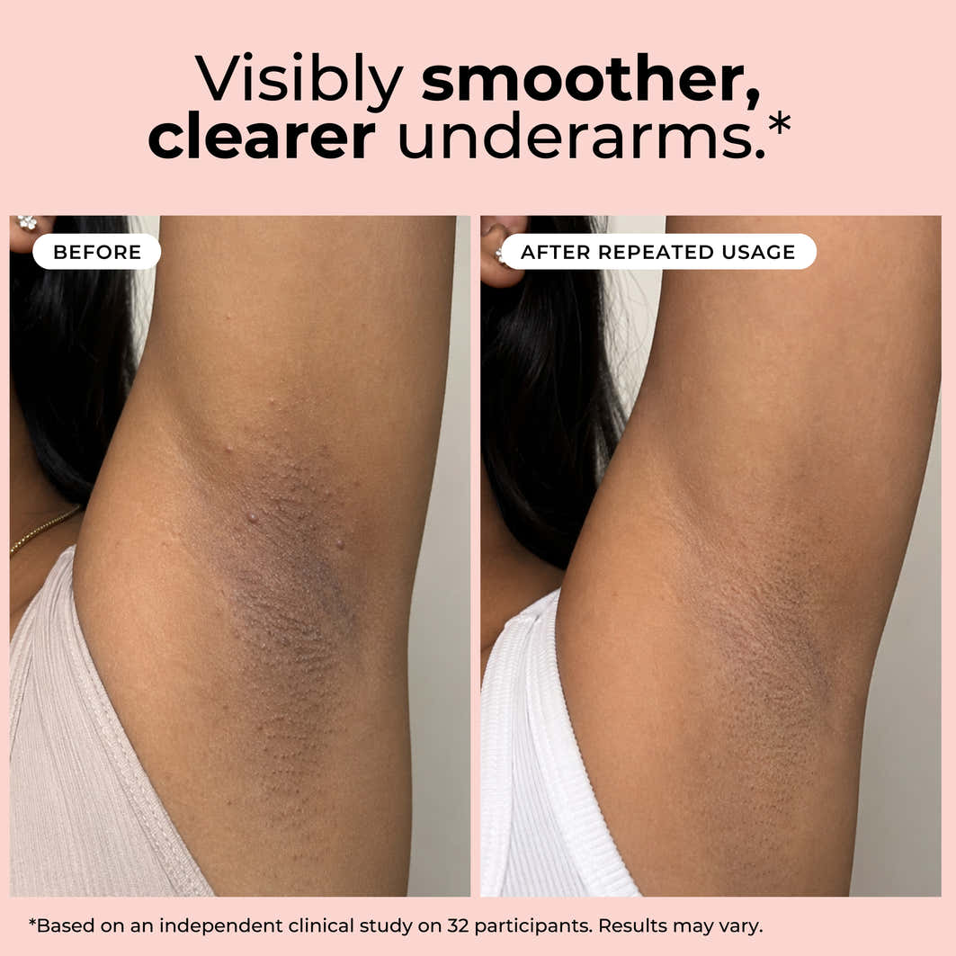 Hula Hoop Smoothening Underarm Roll-On Deodorant