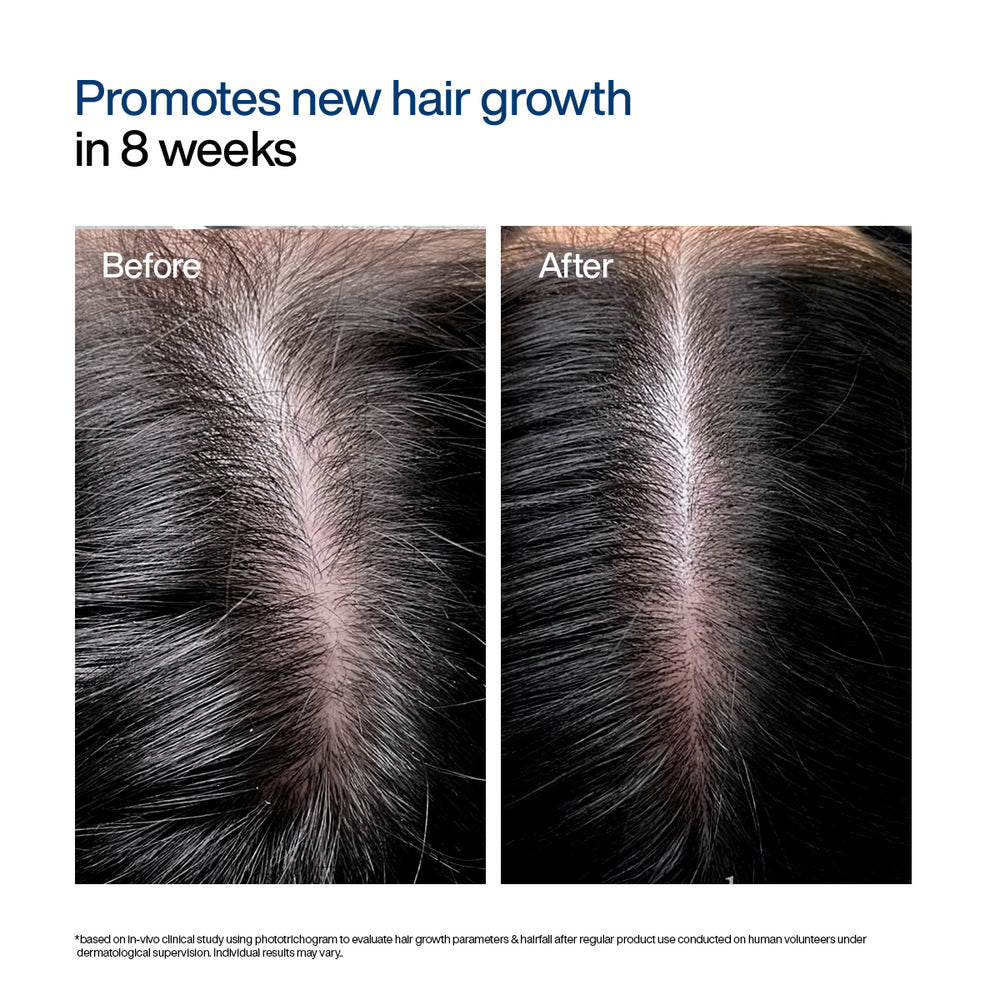 Wishcare Hair Growth Serum Concentrate In-Vivo Tested Redensyl, Anagain, Biotin,Keratin & Rice Water (30ml)