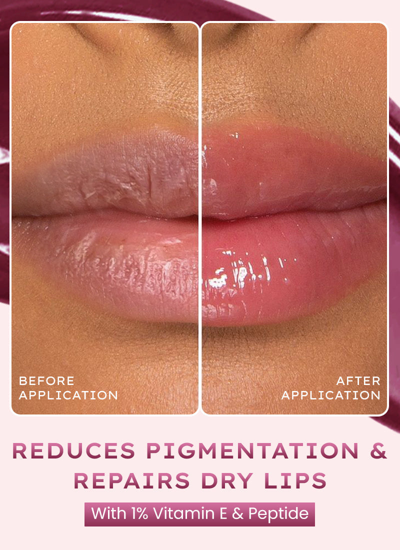 Hyphen Vip orchid lip balm, 1% vit e & peptides- 10g