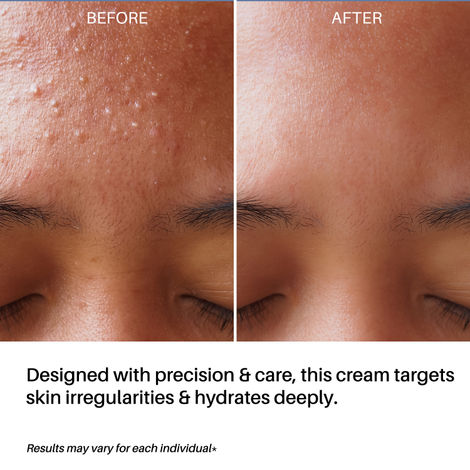 DERMDOC 4% Niacinamide Day Cream (50 gm)