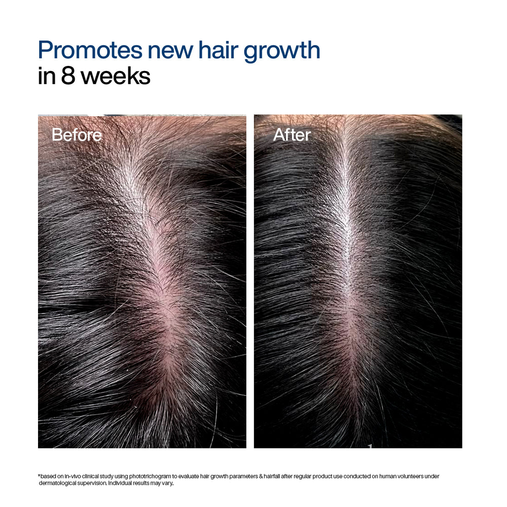 Wishcare Hair Growth Serum Concentrate Roll-On | 30ml