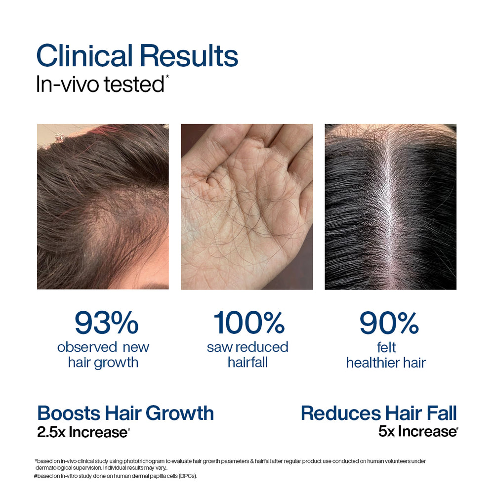 Wishcare Hair Growth Serum Concentrate In-Vivo Tested Redensyl, Anagain, Biotin,Keratin & Rice Water (30ml)