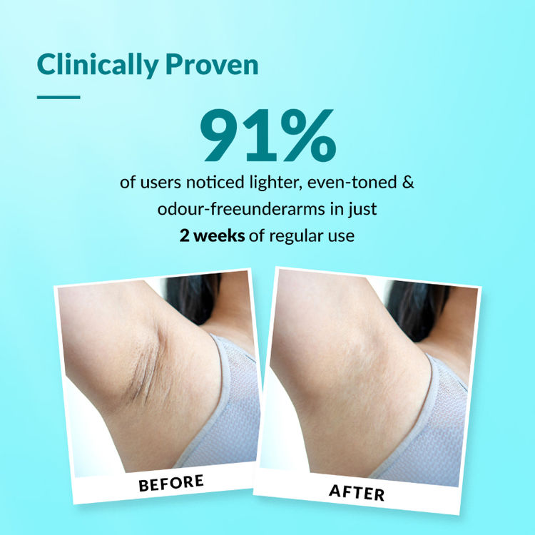 Fixderma Nigrifix 6% AHA Underarm Lightening Roll On Ocean Fragrance
(60ml)