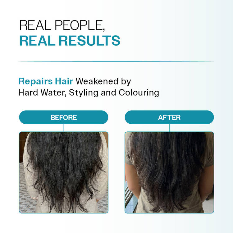 Bare Anatomy Damage Repair Shampoo for Damaged, Dry & Frizzy Hair Paraben & Sulphate Free Shampoo (250ml)
