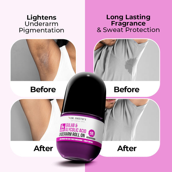 Dr. Sheth's Gulab & Glycolic Acid Underarm Roll On - 50ml