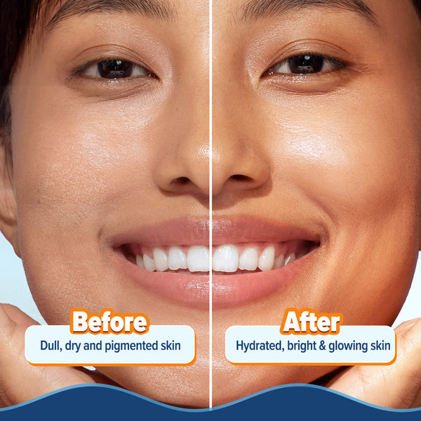 Aqualogica Glow+ Hydra Gel Moisturizer with Vitamin C & Papaya - 200g