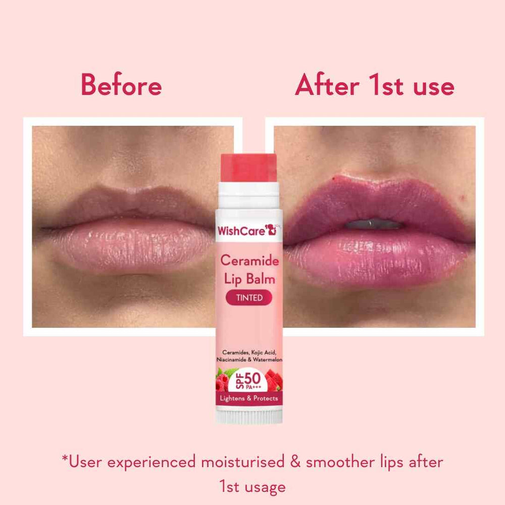 Wishcare Ceramide Lip Balm with SPF 50 PA+++ (Tinted)
SPF Infused Lip Balm for Lip Brightening | 5g