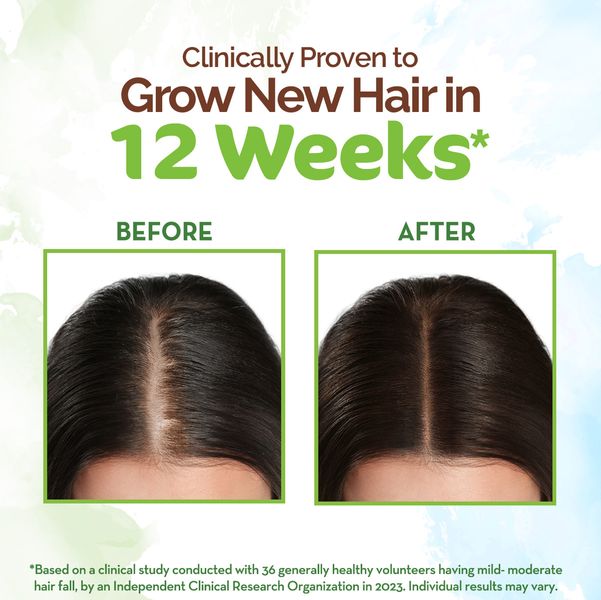 Mamaearth Rosemary Hair Growth Oil with Rosemary & Methi Dana for Promoting Hair Growth - 200 ml