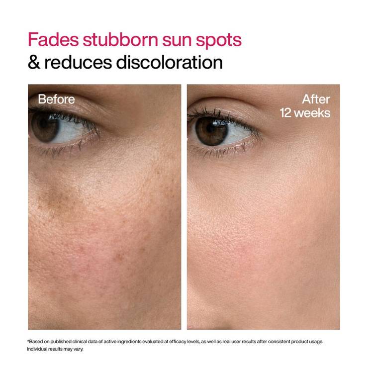 Wishcare Advanced Dark Spot Correcting Txa Shot Serum (30ml)