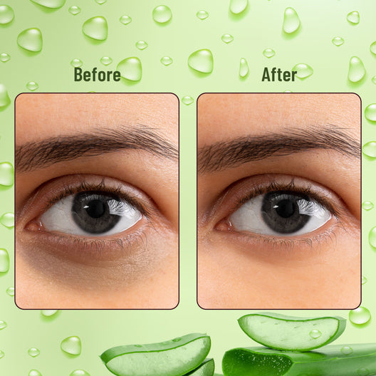 Swiss Beauty Hydra Eye Serum Patch with Aloe Vera