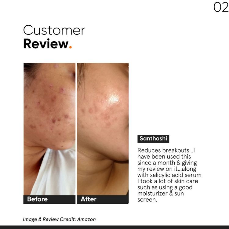 Minimalist 2% Salicylic Acid Face Serum For Blackheads & Whiteheads
(30ml)