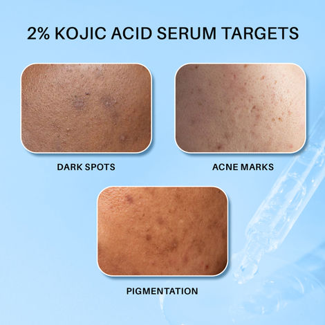 DERMDOC 2% Kojic Acid Face Serum (15 ml)