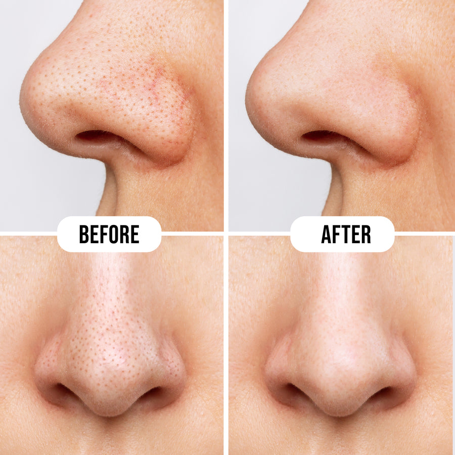 Hilary Rhoda Deep Cleanse Nose Strips 04 Honey