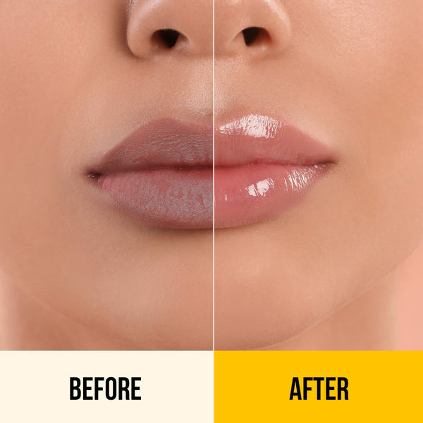 Dr. Sheth's Kesar & Kojic Acid Lip Balm - 10g