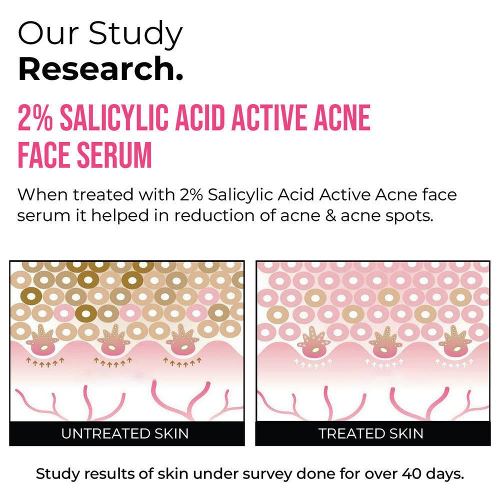 Insight cosmetics 2% Salicylic Acid Active Acne Face Serum