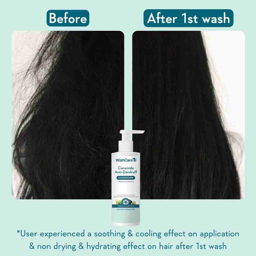 Wishcare Ceramide Anti-Dandruff Conditioner
Nourishing Conditioner with Cermaides & Hyaluronic Acid | 200ml