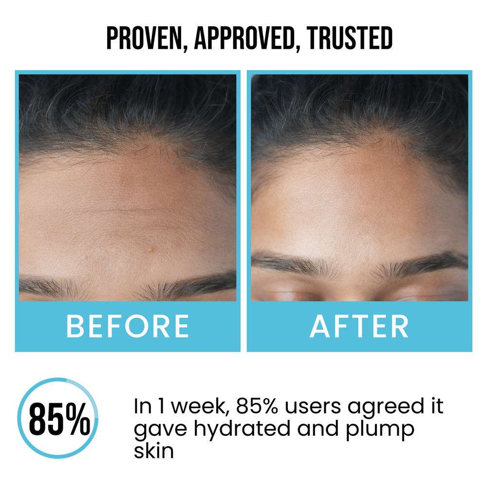 Insight cosmetics 2% Hyaluronic Acid + 2% Alpha Arbutin Face Serum